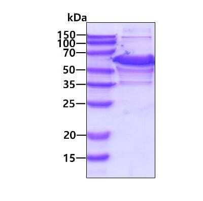 SDS-PAGE Recombinant Human ETS2 His Protein